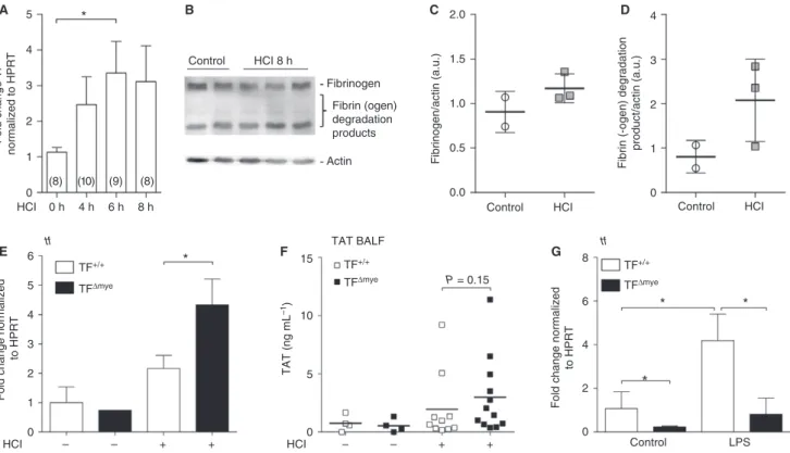 Fig. 1. Tissue factor (TF) expression and activation of coagulation during acute lung injury (ALI)