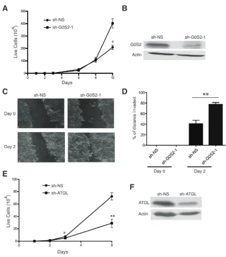 Figure 2: Knockdown of G0S2 enhances cell growth and motility in colorectal cancer cells