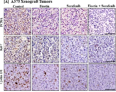 Figure 5: Effects of fisetin, sorafenib and their combination on markers of proliferation in tumor sections of athymic nude mice implanted with BRAF-mutated melanoma cells