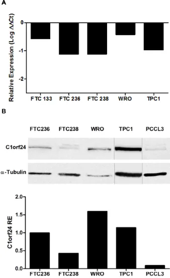 Figure 3: Endogenous expression of miR-106b and C1orf24 in thyroid carcinoma cell lines