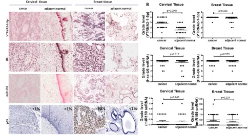 Figure 2: Comparison of VTRNA2-1-5p expression in cervical cancer tissue with inactivated p53 and in breast cancer tissue with mutated p53