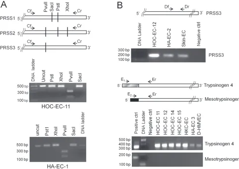 Figure 1: Trypsin expression by endothelial cells. RNA of human endothelial cells from ovarian (HOC-EC) and kidney (HKC-EC) carcinomas, and from non-neoplastic tissues such as skin, adrenal gland (HA-EC), derma and lung (D- and L-HMVEC) was reverse-transcr