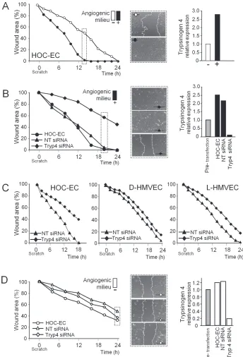 Figure 3: Effect of trypsinogen 4 silencing on the migration ability of tumor endothelial cells