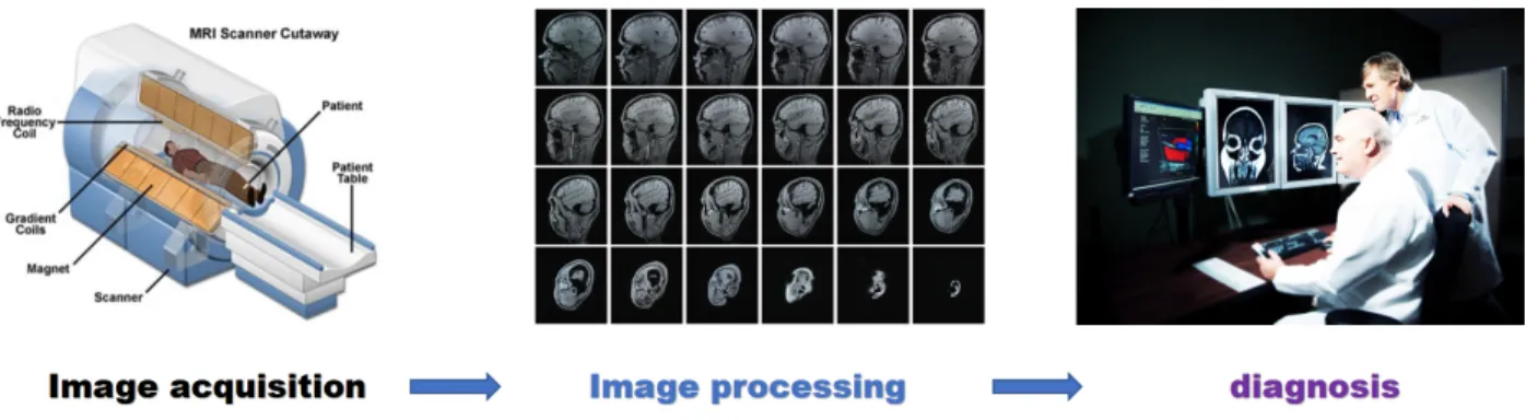 Figure 1.2: A typical imaging assisted diagnosis procedure.