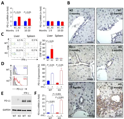 Figure 7: PD-L1 expression in mouse biliary epithelial cells is influenced by IFN-γ. A