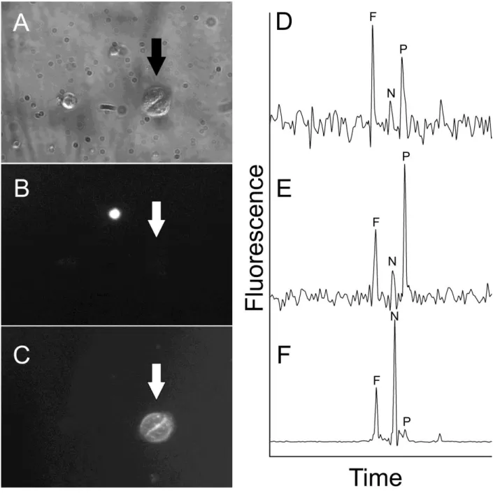 Figure 3.5. Analysis of PTP activity in bronchial brushing specimens.  Viable epithelial  cells from a bronchial brushing specimen were identified, microinjected with pTS13, and  analyzed by CE-LIF