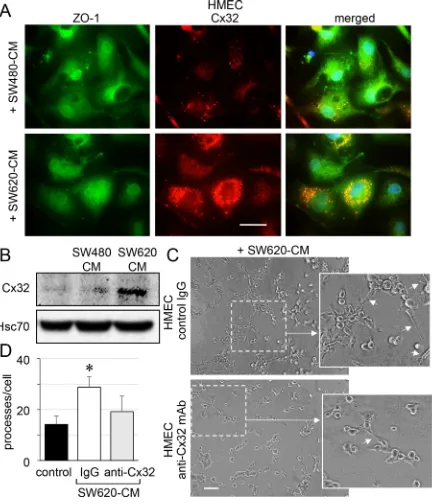 Figure 4: SW620 cell-secreted factors overexpress the endothelial Cx32 favoring tubulogenesis