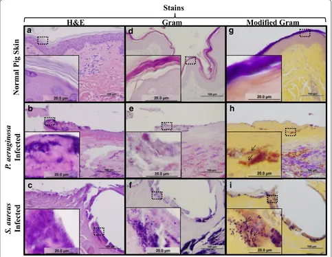 Fig. 4 A modified Gram stain improves bacterial detection in tissue sections. Serial sections of normal porcine skin (a, d, g), P