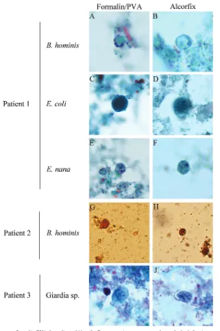 FIG 2 Positive stool specimens cocollected in PVA-formalin and Alcorﬁx. Representative protozoa are shown for both ﬁxative types