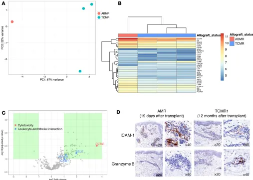 Figure 6. Gene expression profiling of allograft skin biopsies suggests distinctive features in the suspected AMR episode compared with TCMR episodes