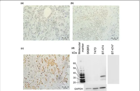 Figure 2 HOXB13 grading and antibody control. Tumor tissue immunostained for HOXB13: (a) weak, (b) moderate and (c) strong