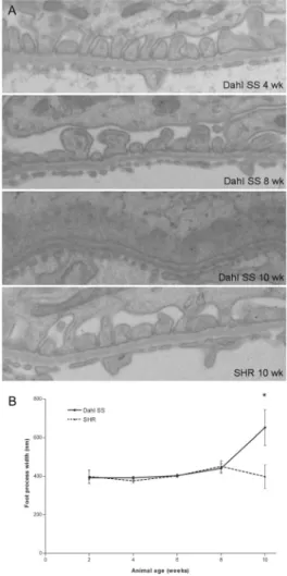 Figure  3.  Electron  microscopy  of  podocytes  in  Dahl  SS  and  SHR rats (A) and evaluation of the mean foot process width  (B)