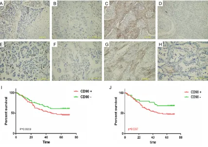 Figure 4. Expression of Thy1 staining in NSCLC by immunohistochemistry and the correlations with overall surviv-als