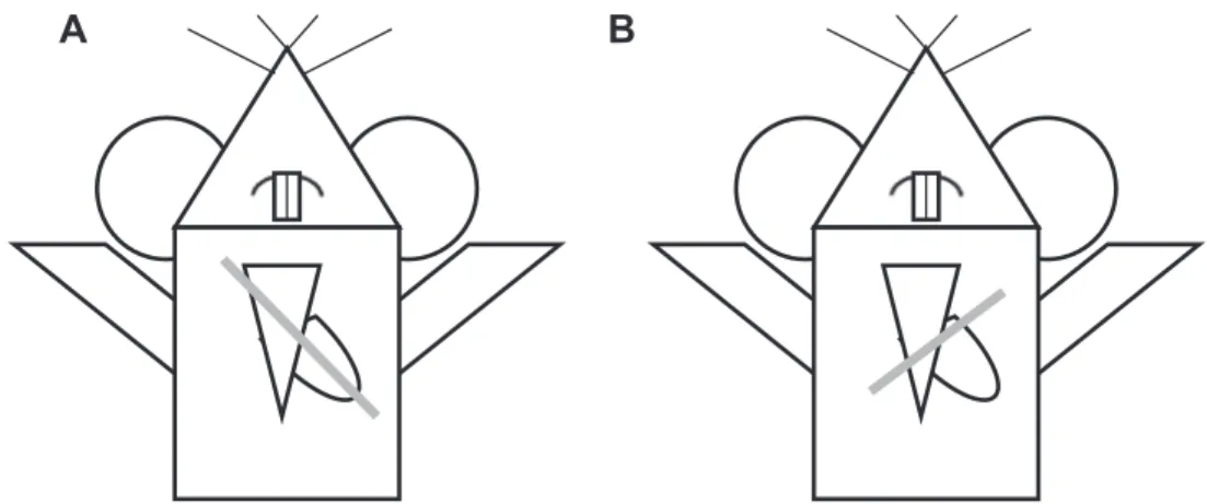 Fig. 1 e Illustration of probe positioning. Gray line indicates probe position to obtain the (A) parasternal long axis view and (B) parasternal short axis view.