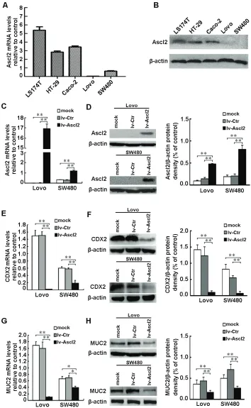 Figure 6: Ascl2 over-expression in CRC cells suppressed CDX2 and MUC2 expression. Ascl2 mRNA and protein levels in HT-29, LS174T, Caco-2, Lovo and SW480 cell lines were detected via real-time PCR analysis and Western blotting assay