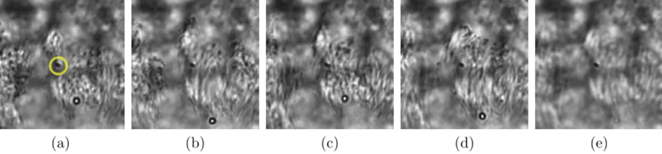 Figure 4.1: Ciliated epithelial lung cells move a bead in bright-field microscopy observed with a long working distance lens