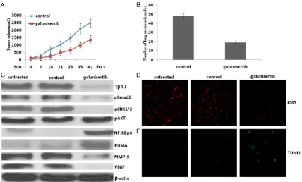 Figure 4. Effects of galunisertib on tumor growth and metastasis in vivo. A. 8505C ATC cells (5 × 106) were inoculat-ed subcutaneously into the right flank of 4- to 6-week-old female athymic nude (nu/nu) mice