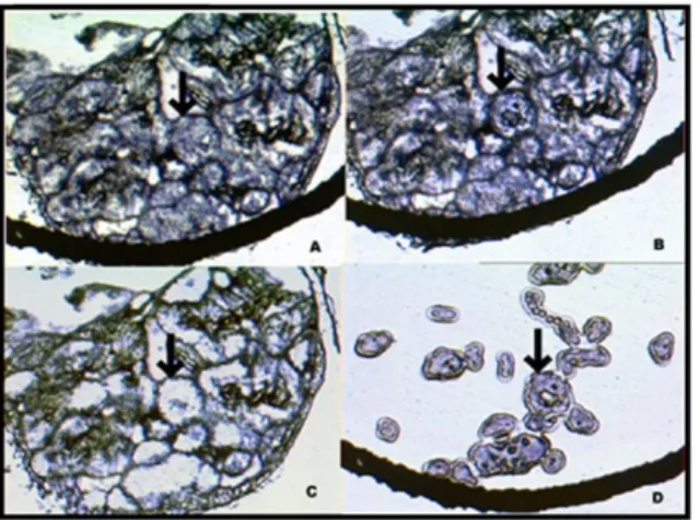 Figure 1.2: Micrograph of Laser microdissection. The arrow shows the cells of interest in all  panels