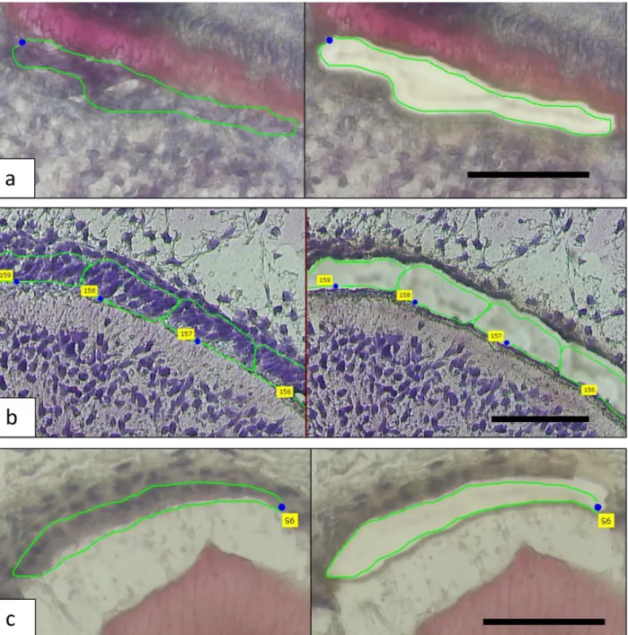 Figure 2.1: The micrographs show the laser capture of a – odontoblasts, b - pre-secretory  ameloblasts and c – secretory ameloblasts