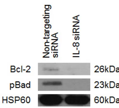 Figure 5: The effect of IL-8 knockdown on the expression levels of anti-apoptotic proteins