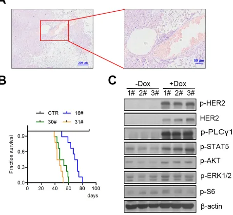 Figure 2: H878Y mutant HER2 is tumorigenic in vivo. A. A representative H&E image of lung tumor of H878Y transgenic mice