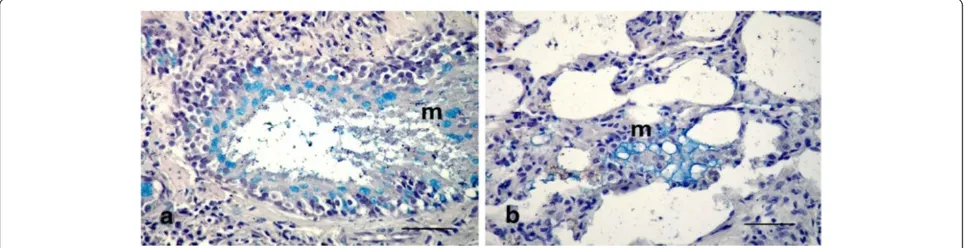 Figure 2 Photomicrographs of hematotoxylin and eosin-stainedsections of the lung in (LTC) group, 15 d p.i