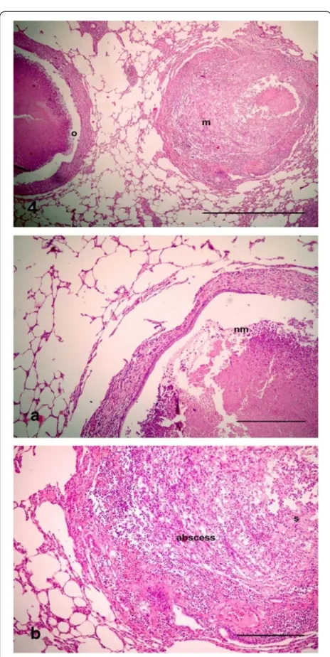 Figure 4 Photomicrographs of hematotoxylin and eosin-stainedObstruction in the bronchioles identified by homogenous materialsurrounded by live neutrophils mixed with mucus inside the lumen(nm), resulting in blockage in the lumen, with ulceration in theepit