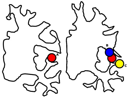 Figure 3.1: Spatial proximity can be a false indicator of correspondence, as illustrated by points lying on opposing sides of a sulcus of the brain