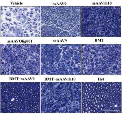 Figure 4. Sciatic Nerve histopathology after AAV/mGALCopt gene therapy with and without  BMT in twitcher mice
