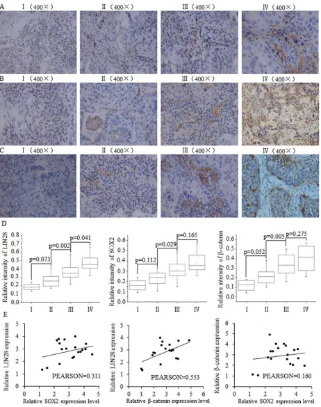 Figure 1: The positive correlation between SOX2/β-catenin and LIN28 and their clinical value in evaluating prognosis of patients with breast cancer