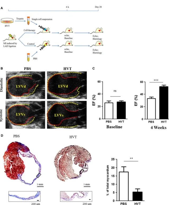 Fig. 3 Cardiac function and fibrosis. (A) Schematic diagram showing the animal procedures