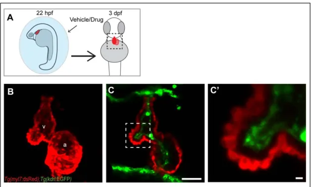 Figure 7 Verapamil treated embryos do not form trabeculae  