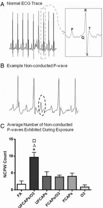 Figure 3. Typical mouse electrocardiogram and arrhythmia count during exposure. A. 