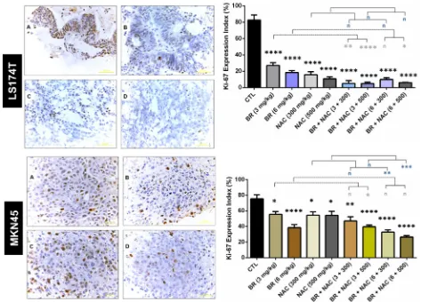 Figure 5: Immunohistochemical analysis of the expression of Ki-67 in the studied gastrointestinal cancer xenografts