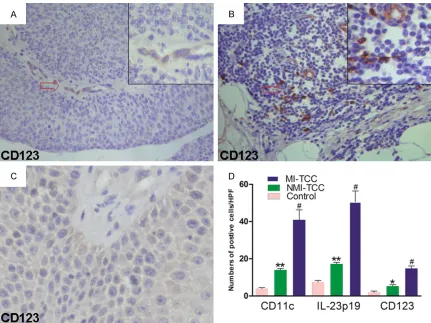 Figure 2. Distribution of CD123+ pDCs in NMI-, MI-TCCs and controls. CD123+ pDCs were detected in the vast major-ity of NMI- (A) and MI-TCC (B), whereas they were virtually absent from the control (C)