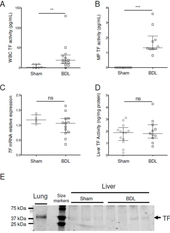 Figure 2. Tissue factor expression in mice with chronic liver injury