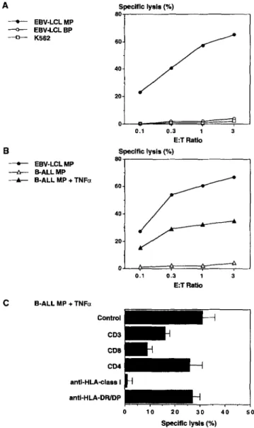 FIGURE  1.  Specific  cytotoxicity  of  CTL  clone  MP1.  A,  Cytotoxicity  against  K562  and EBV-LCL  of  patient  MP  and donor  BP