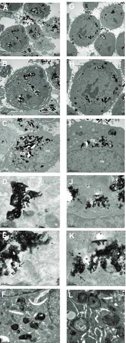Figure 8 Transmission electron microscopic images showing the cellular uptake of ceO2 NPs (A–F) and au/ceO2 NPs (G–L) by a549 cells after 48 hours of incubationNotes: (A, B) cellular uptake of ceO2 NPs
