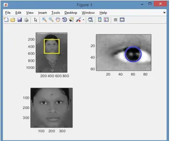 Fig. 3  MATLAB output of eye detection and eyeball tracking 