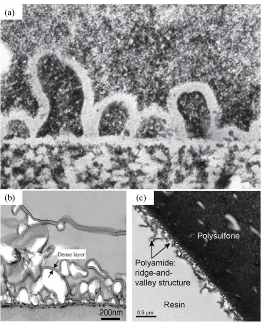 Figure 1.2. (a) A dark-field TEM image of a membrane cross-section that shows the 