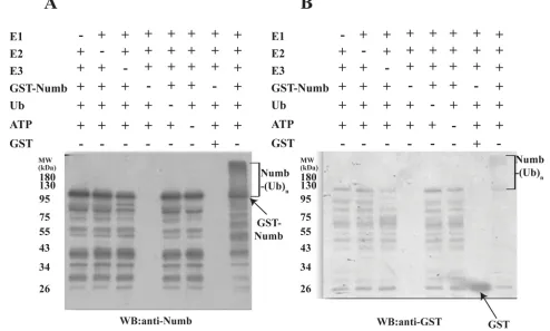 Figure 2: Polyubiquitination of Human Numb by LNX2. In vitro ubiquitination assays were performed for Numb in the presence (+) or absence (−) of each of E1, E2 (UbcH5b), FL-LNX2, GST-Numb, GST, Ubiquitin (Ub) and ATP respectively