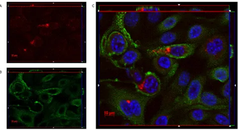 Figure 5: IgGH6 binds and internalizes claudin3 in OSPC-2 cells. OSPC-2 cells were incubated 1 h at 37°C with 2.5 μg/mL of IgGH6 to allow antibody internalization, then cells were fixed, permeabilized and incubated with the Alexa594-conjugated secondary an