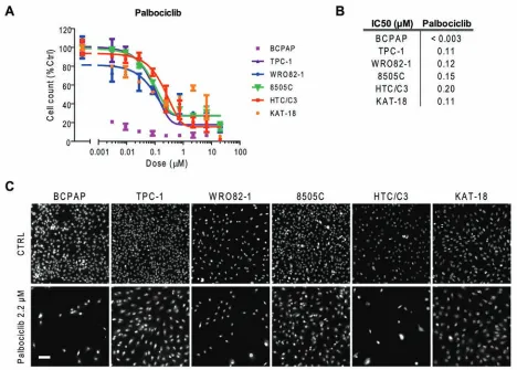 Figure 7: Thyroid cancer cell line sensitivity to palbociclib. A.treated with palbociclib for 72 hours