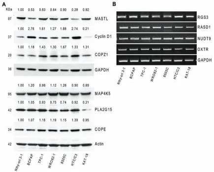 Figure 4: Hit gene expression in different thyroid tumor cells. A.MAP4K5, PLA2G15 and COPE protein expression in a panel of thyroid cell lines; values represent band intensity, assessed by densitometry analysis, reported as the ratio to actin (loading cont