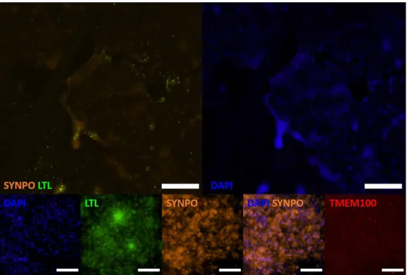 Figure 3.2: Cells grown in 2D at day 21 of differentiation in the Morizane proto- proto-col have differentiated into podocytes