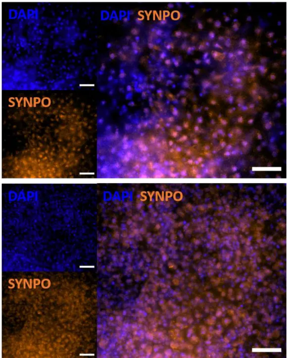 Figure 3.3: Cells grown in 2D at day 28 of differentiation in the Morizane protocol have differentiated into podocytes