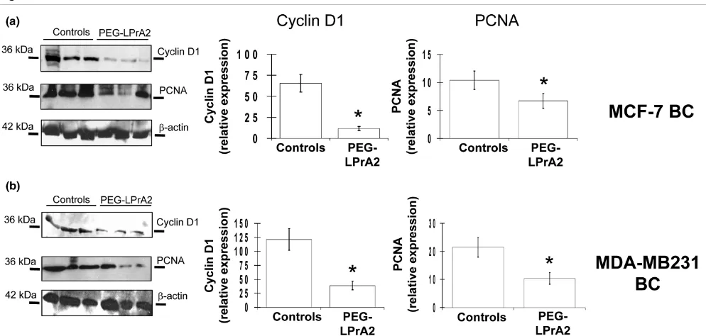 Figure 3Effects of leptin inhibition on levels of proliferating cell nuclear antigen and cyclin DEffects of leptin inhibition on levels of proliferating cell nuclear antigen and cyclin D11