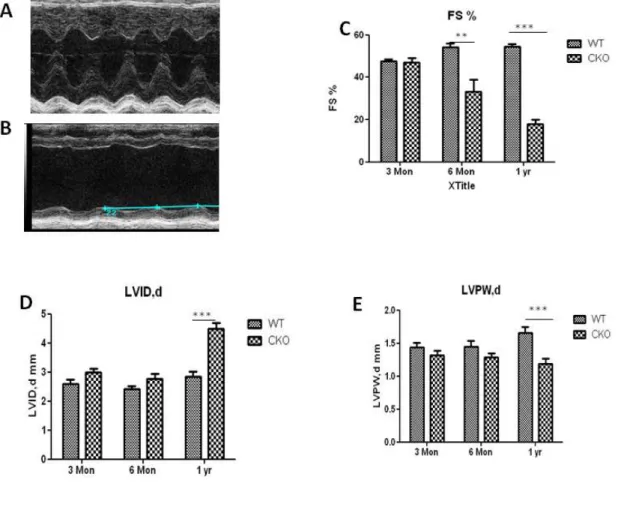 Figure 2.3:  Egfr CKO mice develop marked deficits in heart function.  Representative examples  of echocardiography image of left ventricle from one year old wildtype control (A) and age  matching Egfr CKO mice (B)