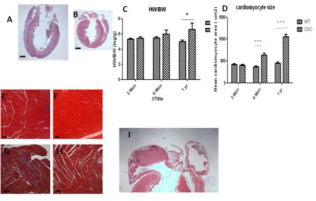 Figure 2.4:  Ventricular dilation and myofiber hypertrophy in Egfr CKO mice.  