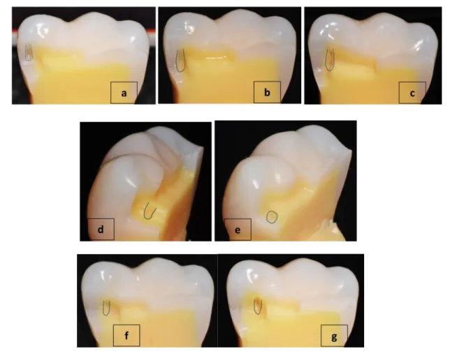Figure 2. 3D models used in exercise on retention groove placement